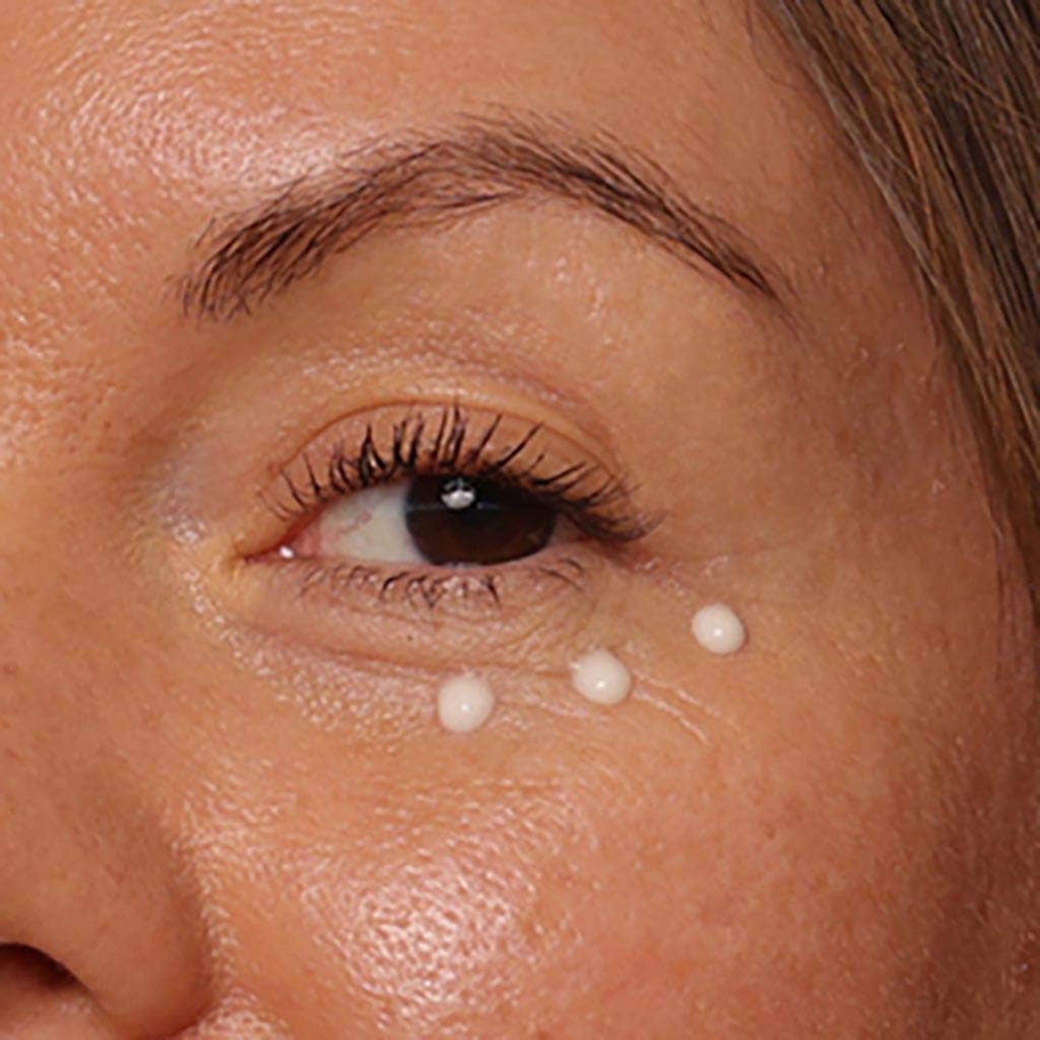 Eye and lip contour with 360º hyaluronic acid