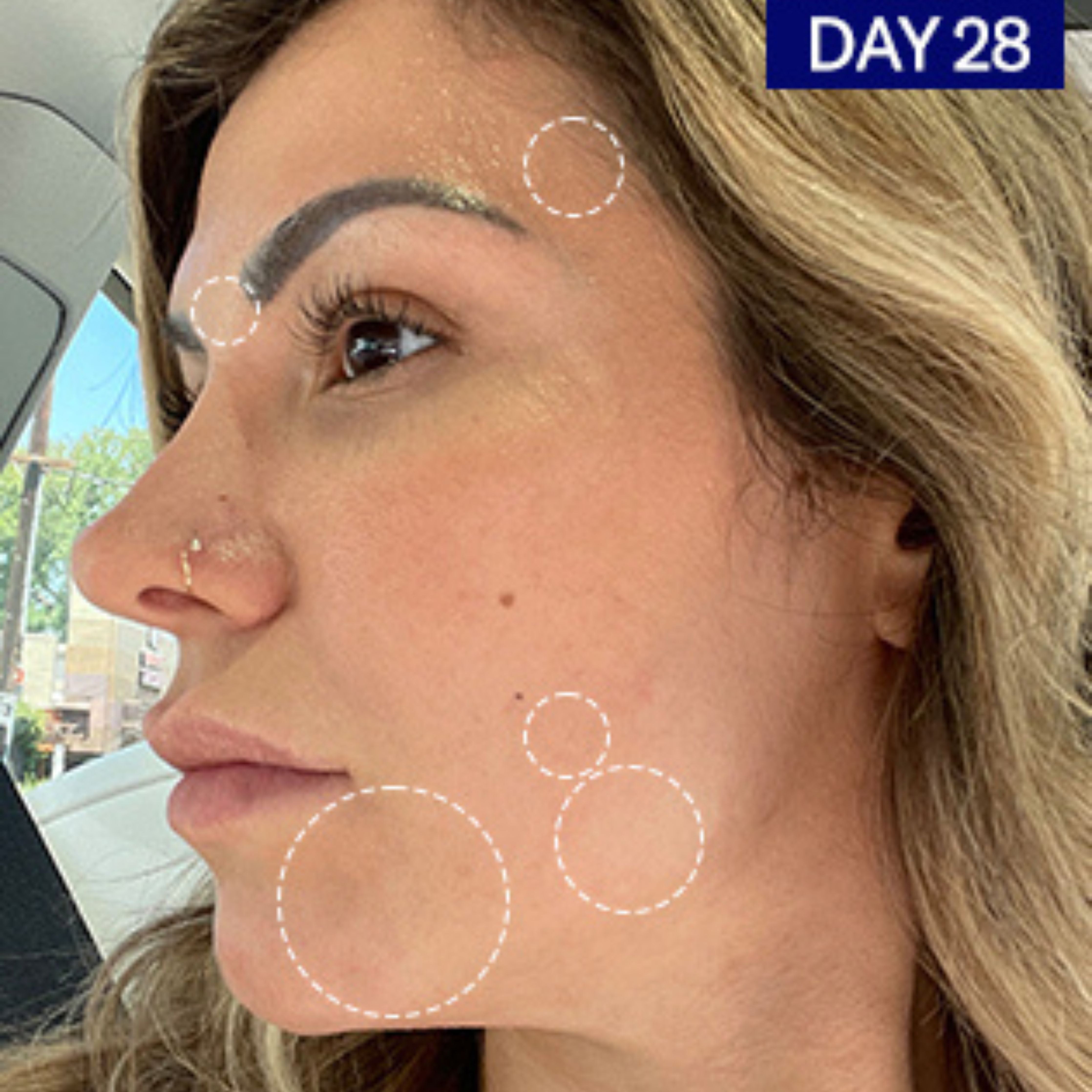 Sérum visage régulateur à l'acide salicylique et à l'acide hyaluronique