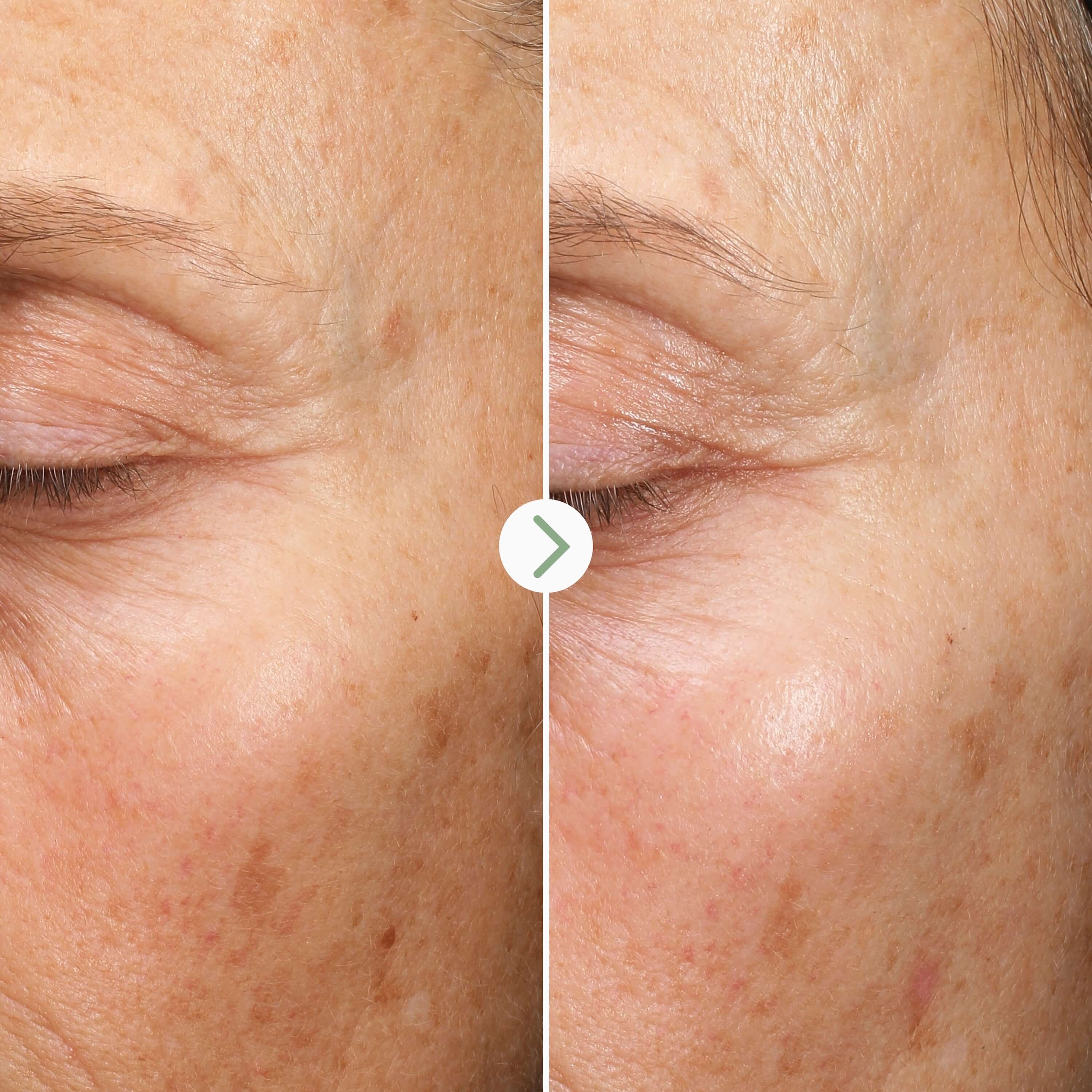 Sérum visage anti-taches aux algues Fade Forward Dark Spot