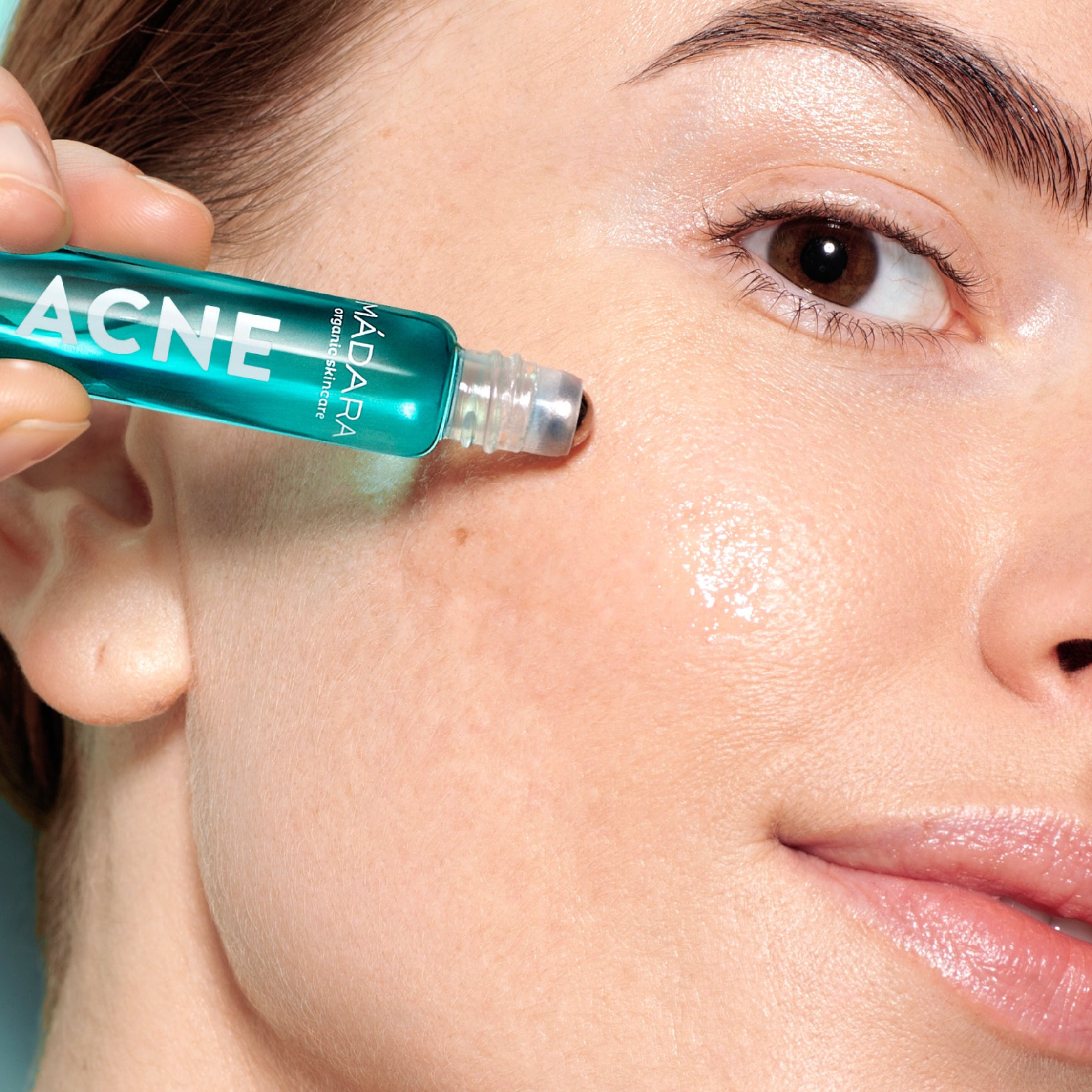 Tratamiento intensivo para acné, poros e imperfecciones ACNE