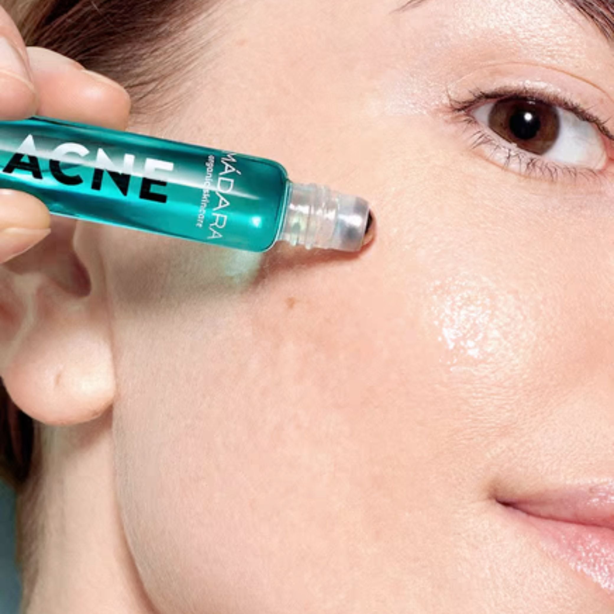 Tratamiento intensivo para acné, poros e imperfecciones ACNE