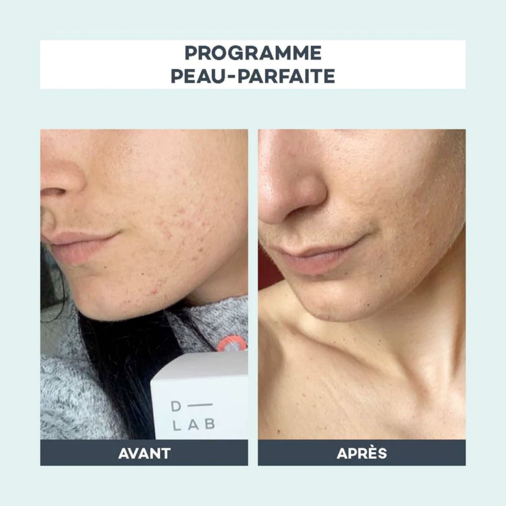 Programme peau parfaite