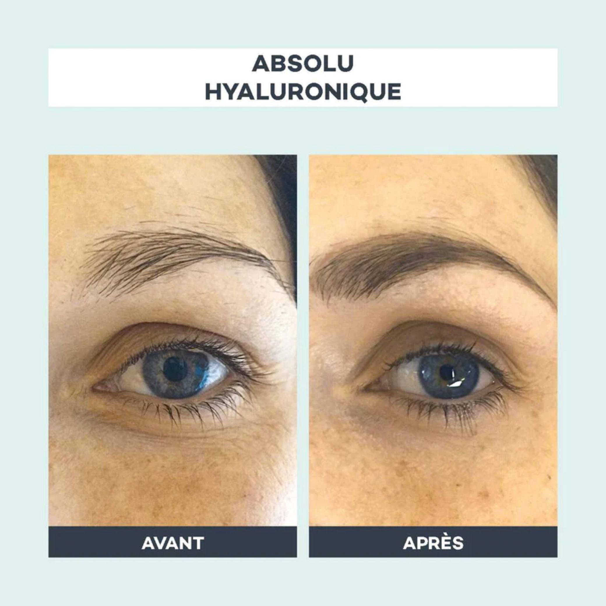 Absolute hyaluronic acid capsules