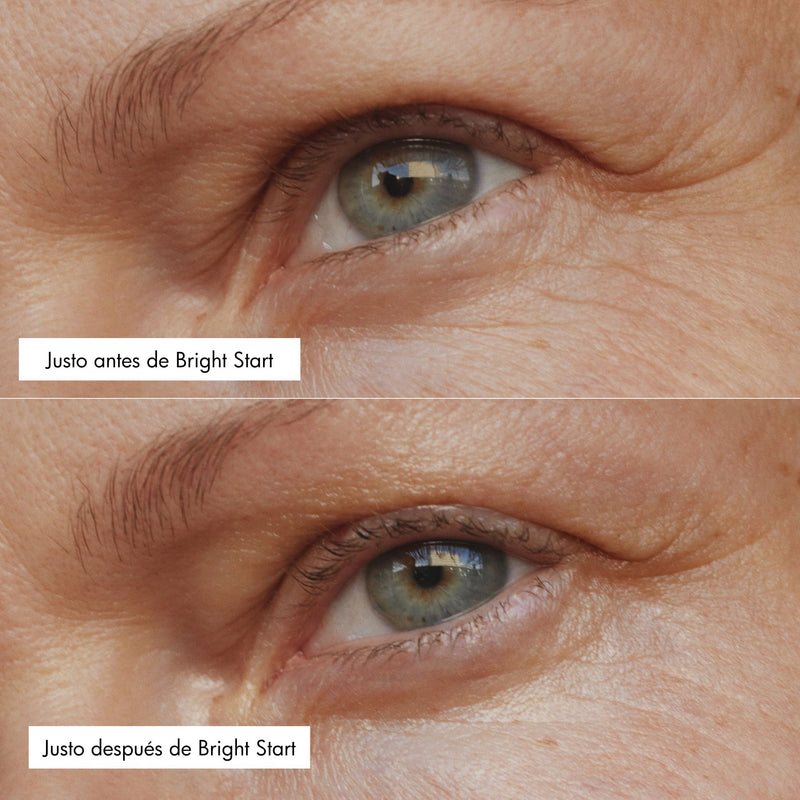 Contornos de ojos con retinol y cafeína Bright Start
